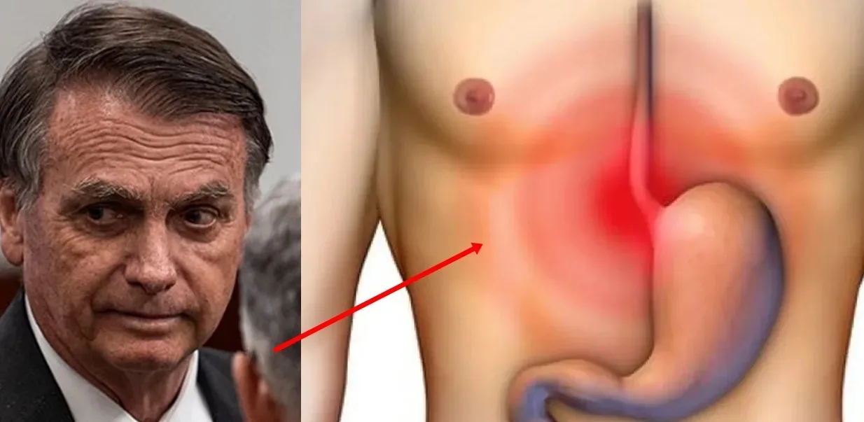 Médicos de Bolsonaro vem à publico é decide revelar seu verdadeiro estado de saúde ao Brasil
